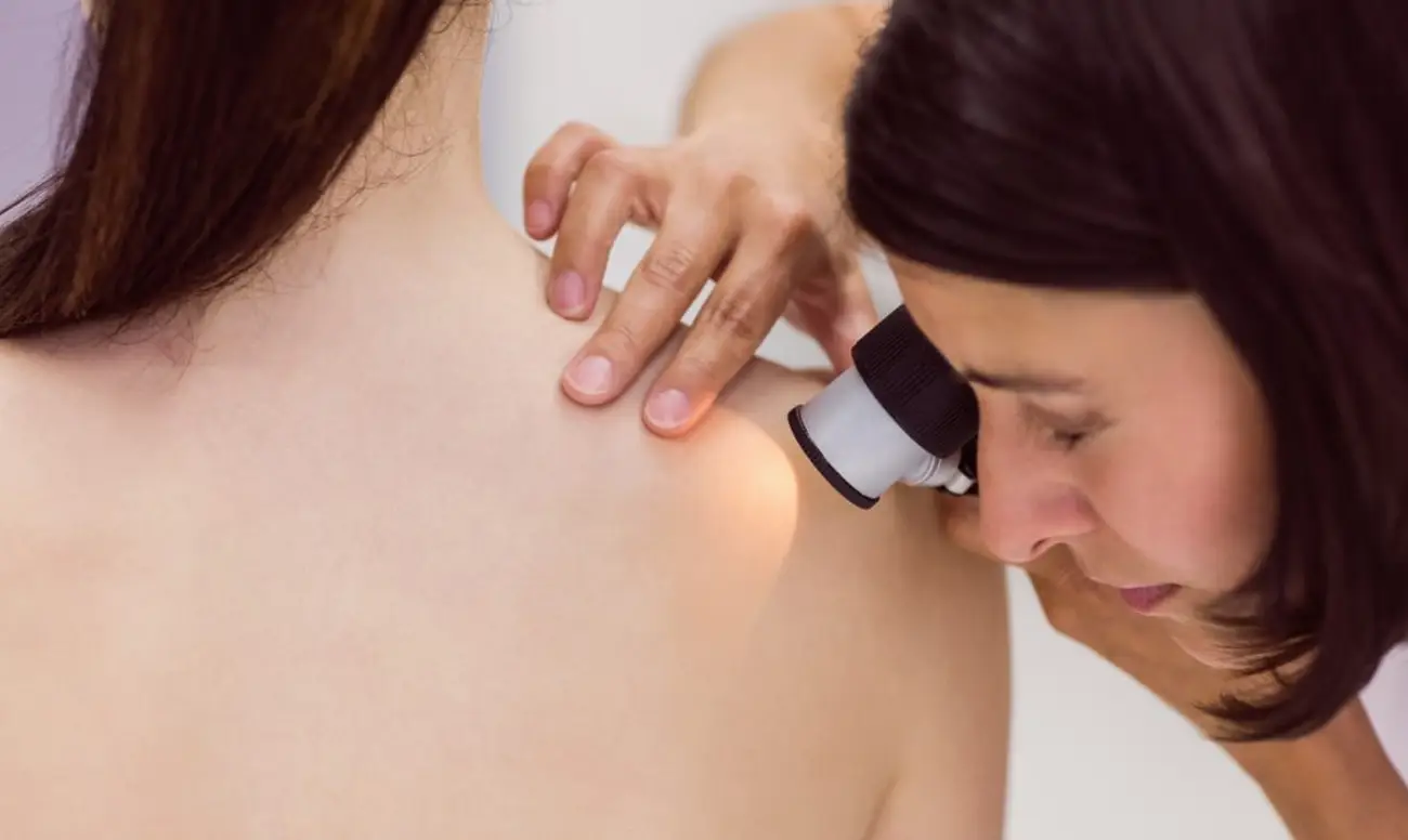 Видалення папілом в Дрогобичі