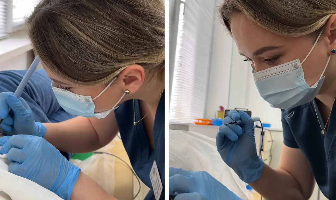 Видалення папілом, бородавок, родимок, кератом, фібром, контагіозних молюсків, себорейних новоутворень, судинних зірочок, ангіом радіохвильовим методом в Дрогобичі